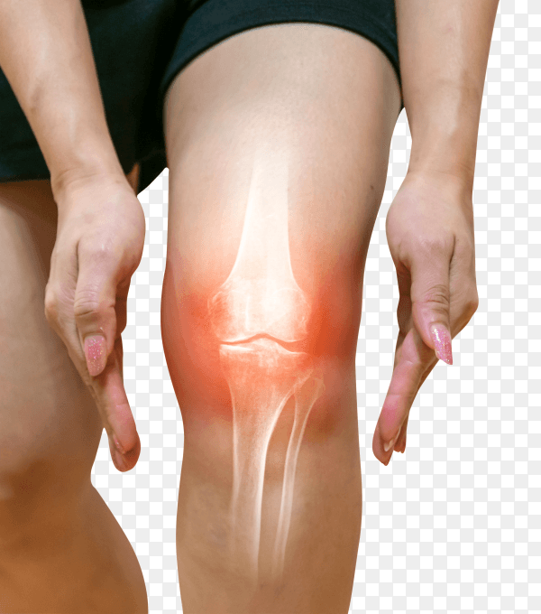 Human leg osteoarthritis inflammation of bone joints Premium image PNG