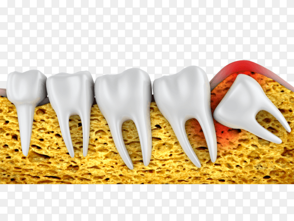 Teeth falling out isolated on transparent backgound PNG